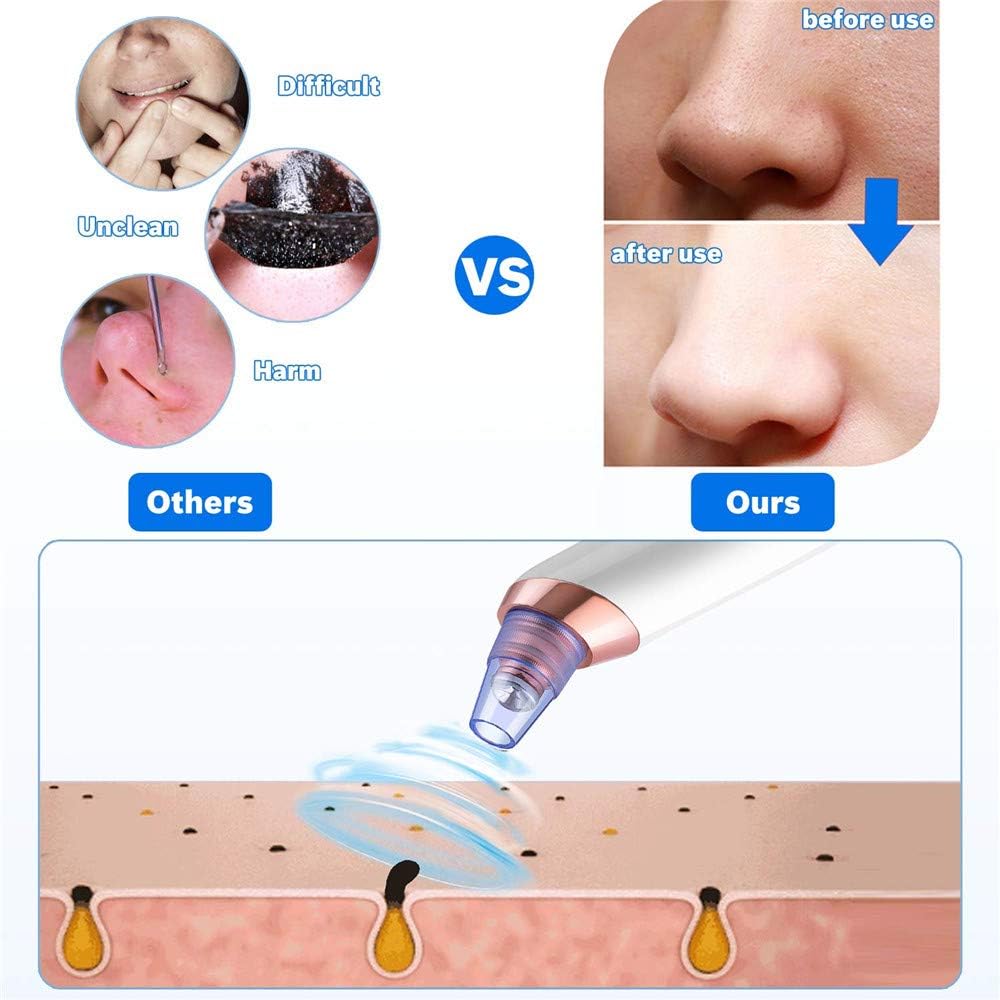 Blackhead Remover Pore Vacuum, USB Rechargeable Acne Comedone Whitehead Extractor for Women & Men
