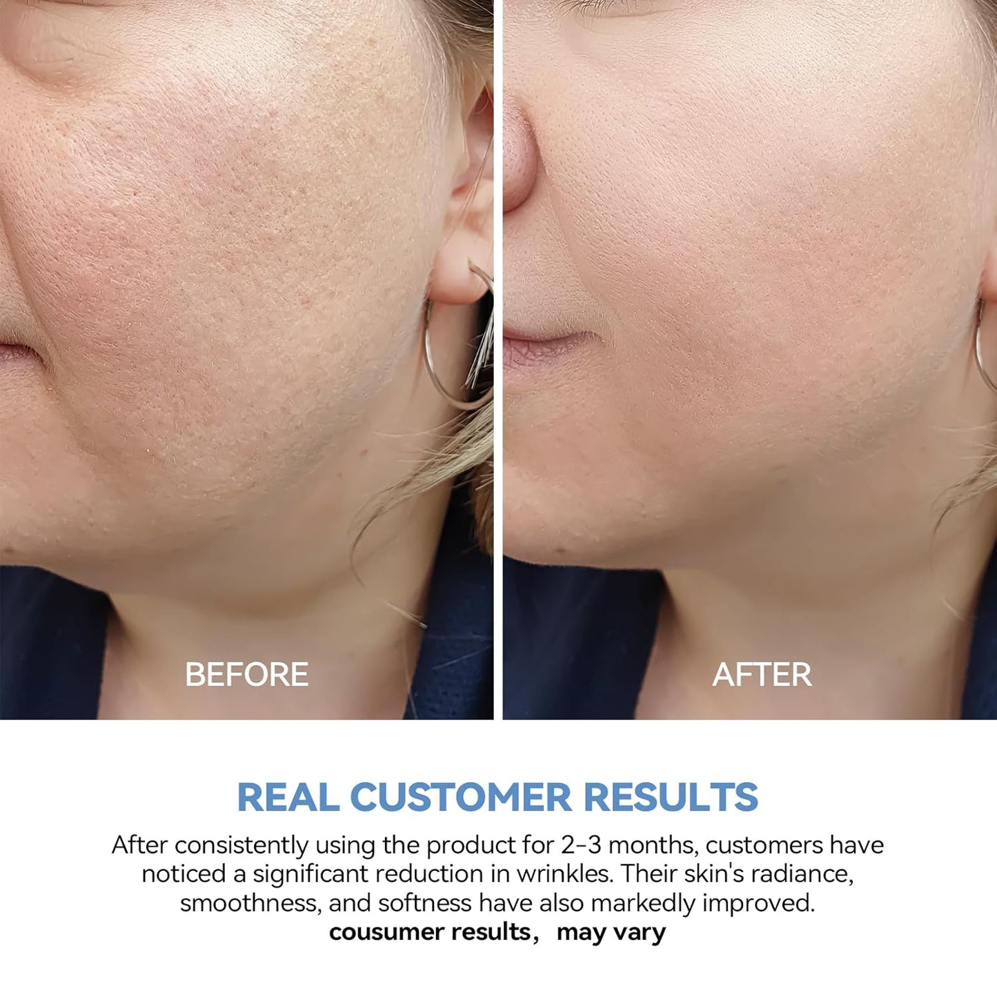 Ultra Hydrating Serum 3% Hyaluronic Acid Smoother Skin|Pre-Makeup Skincare|Anti-Aging Serum for Face Single-Use Vials Skincare|For Sensitive Skin|4D Hyaluronic Acid (120Ml)
