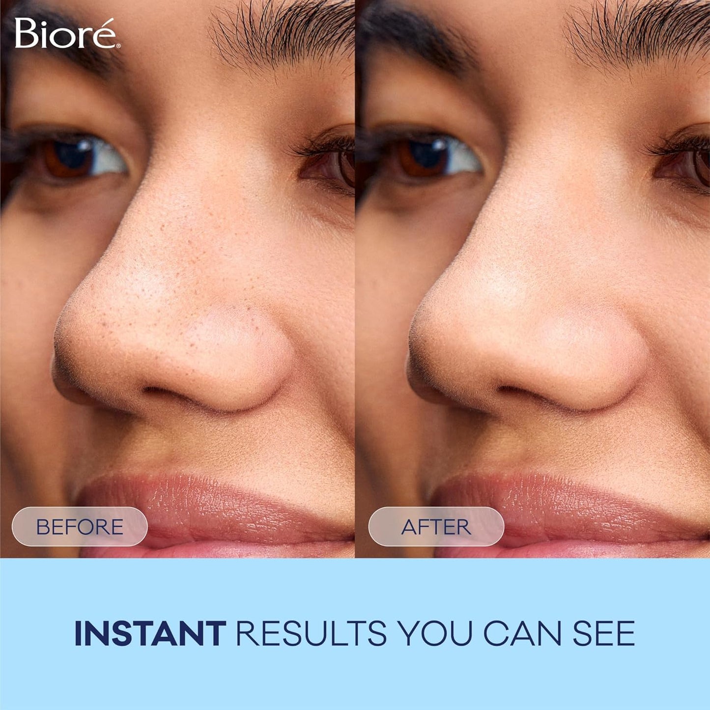 Original Blackhead Remover Strips, Deep Cleansing Nose Strips with Instant Pore Unclogging, Features C-Bond Technology, Oil-Free, Non-Comedogenic Use, 14 Count